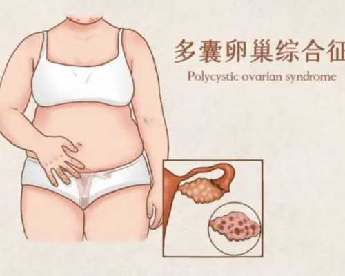 广州怎么去找代孕|试管婴儿移植怀孕后需不需要保胎？